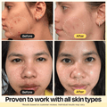 Deep Cleansing Nose Strips for Acne & Blackhead Removal Shrink Pore Nose Black Head Stickers Refreshing Skin Care Patch